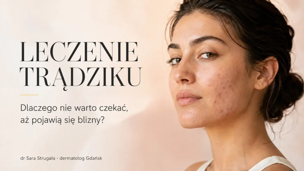 Leczenie trądziku – dr Sara Strugała, dermatolog Gdańsk